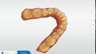 How to export an STL file from CEREC or Connect