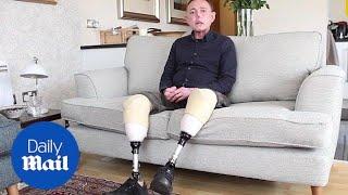 Man loses part of limbs after contracting sepsis from his dog