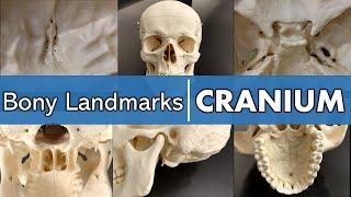 Bony landmarks of the cranium