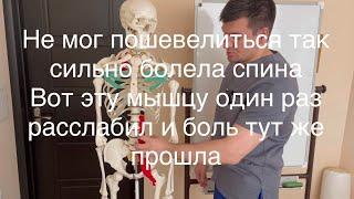 Так сильно болела спина что не мог ходить. Расслабил эту мышцу и боль сразу прошла