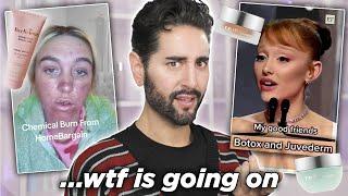 The worst Of Beauty Tiktok - Low-Tox Parents, Ariana Grande Thanks Botox & Cleanser Chemical Burns!