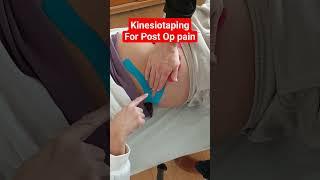 #post #operation #pain #kinesiotaping #kinesiotape