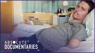 From A Common Cold To Losing My Limbs: Alex Lewis Story | Absolute Documentaries