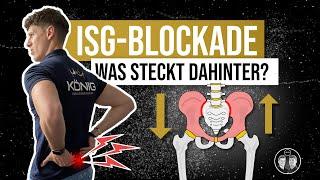 Was ist eine ISG-Blockade? [Schmerzen und Symptome]