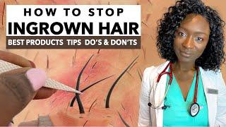 How to Stop Ingrown Hair & Razor Bumps from Waxing & Shaving | Treatments & Products | Black Skin