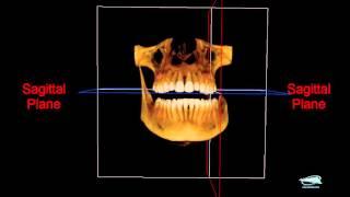 Axial Sagittal & Coronal planes of a CBCT scan