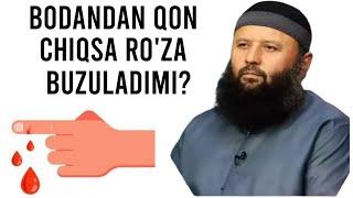 BADANDAN QON CHIQSA RO'ZA BUZULADIMI?-(Shayx Sodiq Samarqandiy)