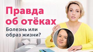 ПРАВДА об ОТЁКАХ лица: болезнь или образ жизни?