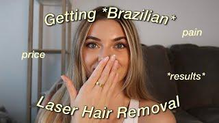 Getting Brazilian Laser Hair Removal // Pain, Price, *RESULTS* + More!