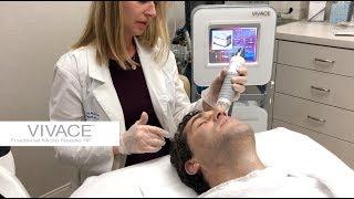 Vivace Fractional Micro Needle RF