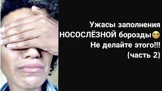 Филлеры и контурная пластика: последствия инъекций и осложнения заполнения носослезной борозды