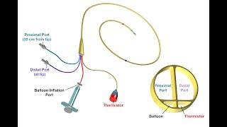 Proper Insertion and Use of a Pulmonary Artery Catheter -- BAVLS