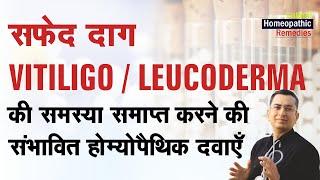 सफेद दाग || Vitiligo || Leucoderma || Natural homeopathic remedies with symptoms