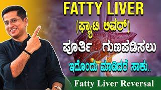Fatty Liver ಪೂರ್ತಿ  ಗುಣಪಡಿಸಲು ಇದೊಂದು ಮಾಡಿದರೆ ಸಾಕು | Fatty Liver Treatment & Symptoms in Kannada