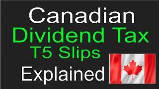 Canadian Dividend Tax Credit Explained!