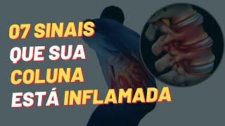 07 Sinais Que Sua Coluna Está Inflamada