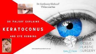 Keratoconus and rubbing your eyes. Is eye rubbing good or bad? Dr Anthony Maloof - Sydney, Australia