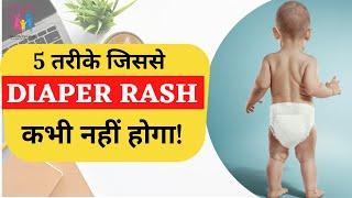 Diaper rash prevention Diaper rash treatment Diaper rash home remedies #diaperrash #diaper