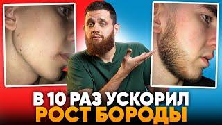 Ускорил рост бороды в 10 раз С НУЛЯ / Результаты ксиноксина