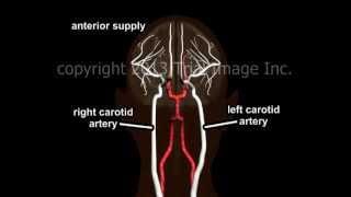 Blood Supply to the Brain - Animation and Narration by Dr. Cal Shipley, M.D.