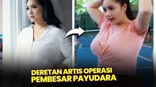 Demi Penampilan, 12 artis Lakukan operasi plastik di payudara