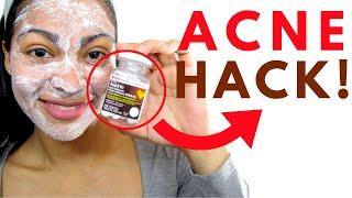 ASPIRIN FACE MASK!!!