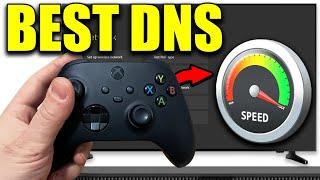 Best DNS Server For Xbox Series X/S - 2024