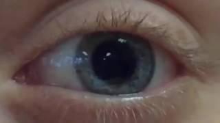 Pupil Dilation and Contraction