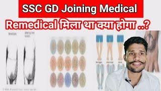 SSC GD Joining Medical ।। Remedical मिला था क्या होगा ..?