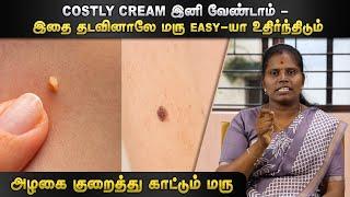 அழகை குறைத்து காட்டும் மரு | Dr.Y.Deepa | HTT