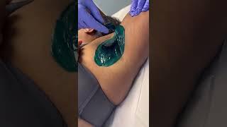 Professional underarm wax using Starpil blue hard wax. #esthetician #waxing