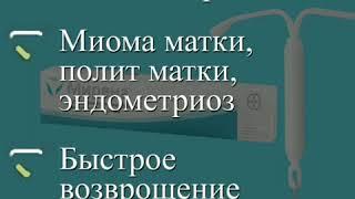 6 причин купить спираль Мирена