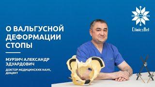 Вальгусная деформация стопы