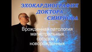 Патология аорты и легочной артерии: транспозиция, двойное отхождение, тетрада Фалло, ОАС