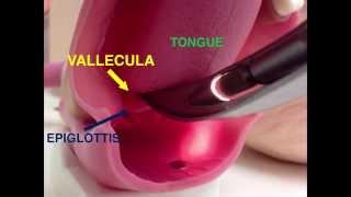 Airway Devices 01: Direct Laryngoscopy