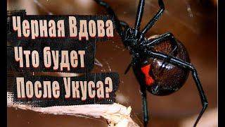 Самый ядовитый паук в России / Последствия укуса / Каракурт или Черная Вдова