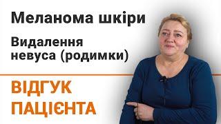 Меланома шкіри. Видалення невуса (родимки) - відгук пацієнтки клініки Добрий Прогноз