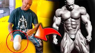 THE TRAGIC END of FLEX WHEELER (he lost his leg) Documentary