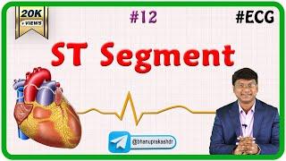 12. ST Segment - ECG assessment and ECG interpretation made easy