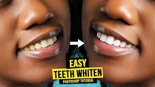 How to WHITEN TEETH in Photoshop | Easy Retouching Tutorial