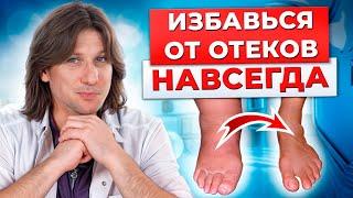 СТРАШНЫЕ последствия ОТЕКОВ! Эти эффективные упражнения избавят от ОТЕКОВ