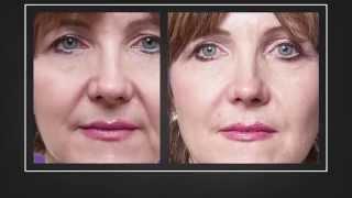 Echelon Medical Spa- Transformations