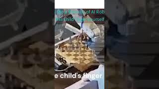 Shocking: AI Robot Breaks Child's Finger During Chess Game in Moscow! Is AI a real threat to humans?