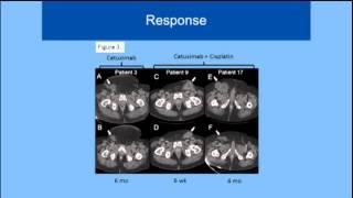 EGFR-targeted therapy for advanced penile or scrotal cancer