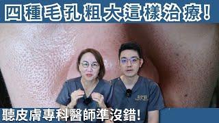 當心毛孔粗大像橘皮！毛孔粗大四類型！醫美治療與保養品改善你適合哪一種？