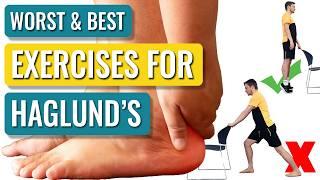 Haglund’s Deformity Exercises — The Best and the Worst