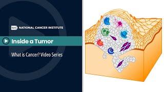 Inside a Tumor: What is Cancer? Video Series