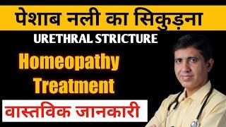 Urethral Stricture Homeopathy | Real Facts | पेशाब नली का सिकुड़ना |Homeopathic Treatment | Dr Ramdeo