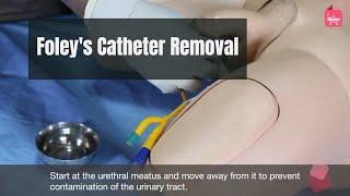 How to Remove urinary (foley's ) catheter (male) ?