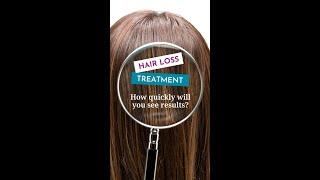 Hair Loss Treatment. How quickly will you see results?  Part 2 of 2.